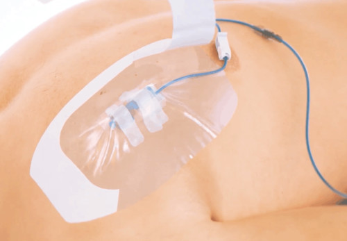 Polyfilm™ — opatrunek do mocowania igły Hubera